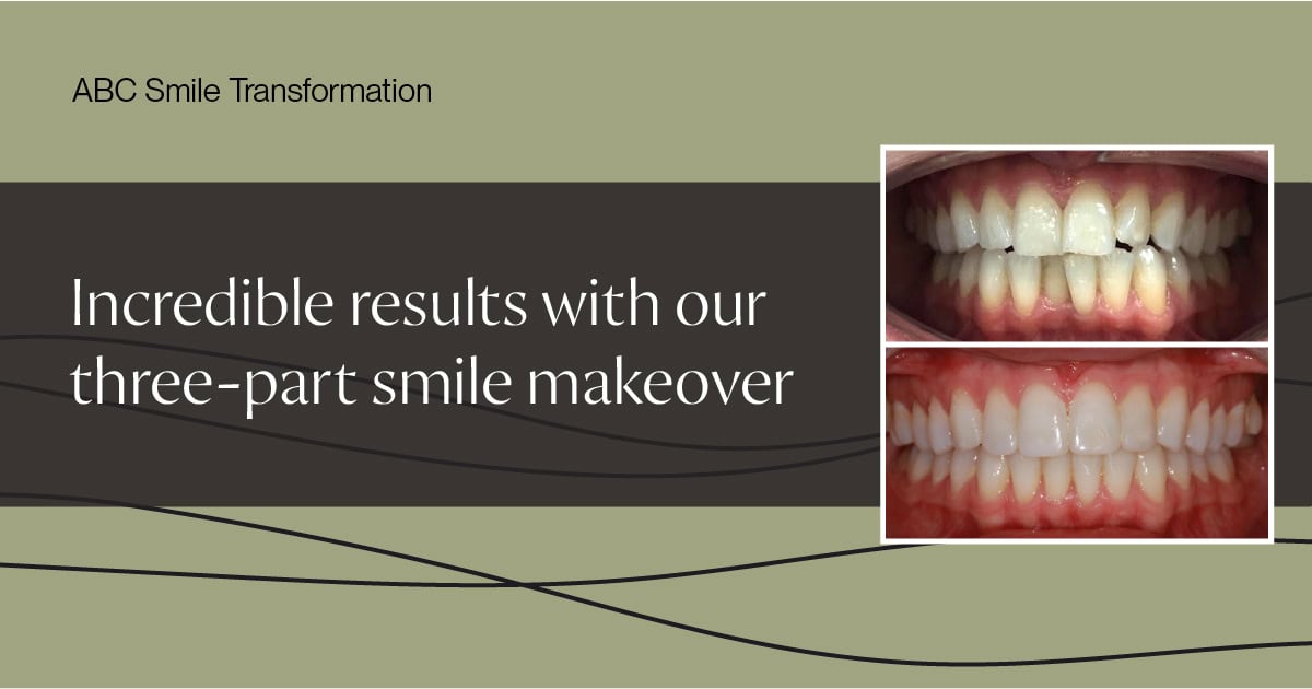 ABC Smile Makoever Holly featured image